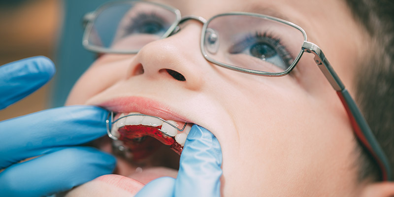 Ortodonzia per bambini