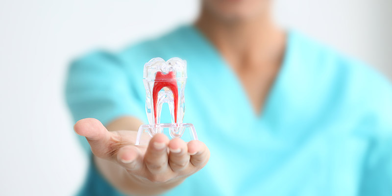 Dentalorent trattamento endodontico