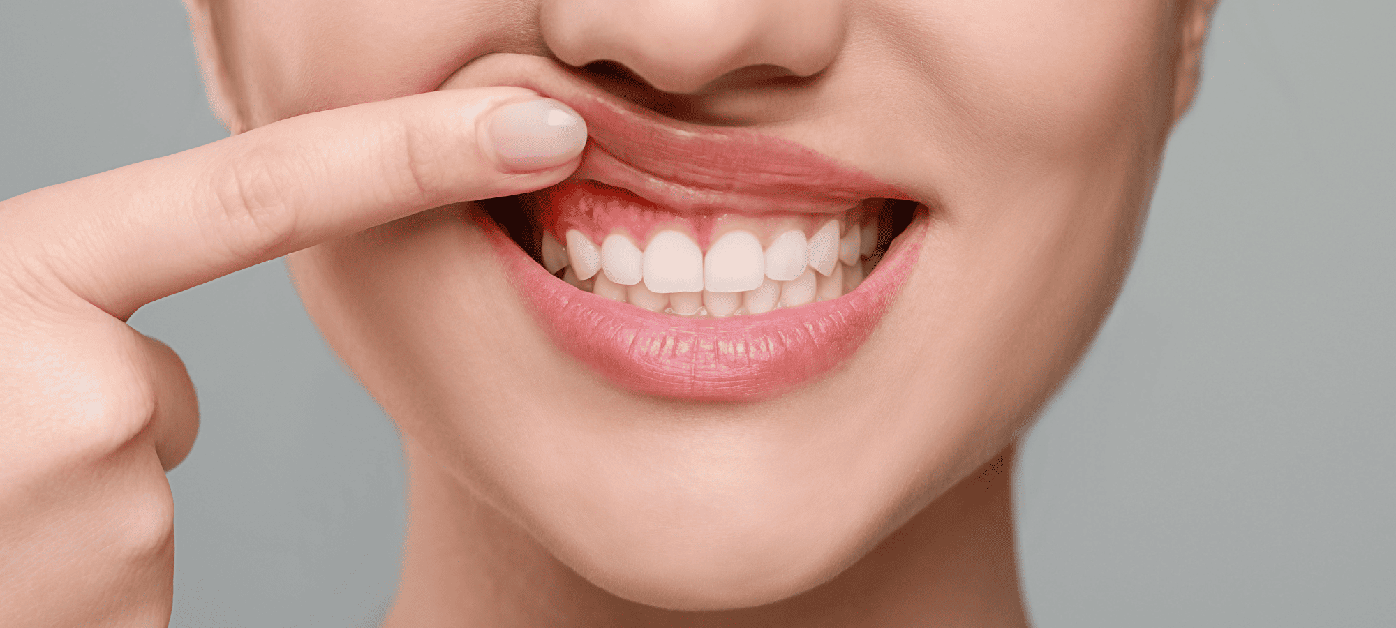 prevenzione della parodontite: tutti i consigli